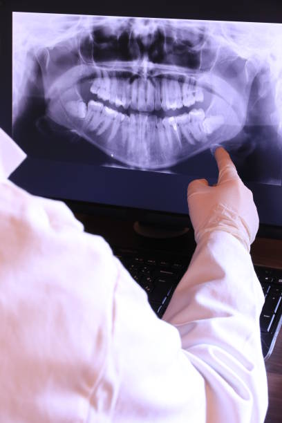 Best Emergency Tooth Extraction in Leland, NC